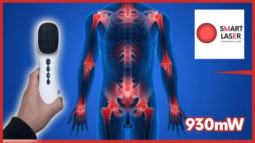 SMART LASER - HD-CURE PRO Home Medical Laser 930mW - kézi lágylézer készülék - Gyógyító lézer otthoni használatra
